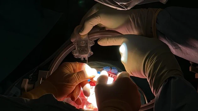Fih Intraop