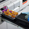 Siemens Healthineers Press Dx Adlm 2026 Capillary Testing