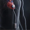 An ITEN battery in an implantable medical device.