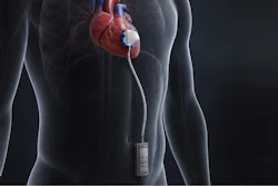 An ITEN battery in an implantable medical device.