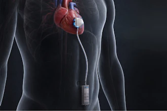 An ITEN battery in an implantable medical device.