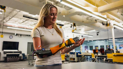 Limbitless Stratasys Annika