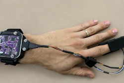 A prototype of the ChromaSense pulse oximeter, which can read accurate blood oxygen saturation levels regardless of skin tone, age, and other factors that often introduce errors in many devices used in clinics today.