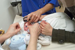 A premature baby is examined for the eye disease Retinopathy of prematurity (ROP).
