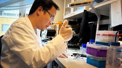 Xinxin Liu prepares a newly-fabricated nanopore membrane for evaluation. The new method simplifies production of large arrays of nanopores for sensing and analysis technologies used in medical research and, increasingly, in specialized clinics.
