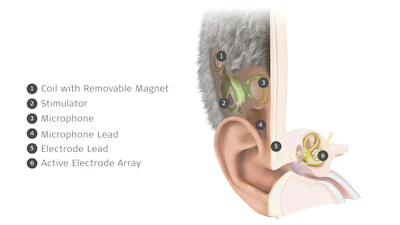 Low 014 Tici Anatomy Mkt V002 1