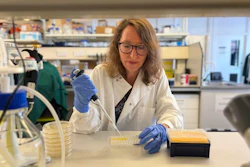 Senior author Professor Jennifer Rohn (UCL Division of Medicine) pipetting in her laboratory.