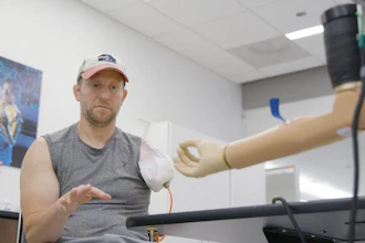 Shirley Ryan AbilityLab is pioneering a first-of-its-kind clinical study that could redefine the future of upper-limb prosthetics. Recently, the study reached a major milestone when a Chicago-area man underwent an operation at Northwestern Medicine that consisted of implanting a titanium fixture into the bone of the residual limb and placing electrodes onto his muscles and around his nerves. Now, he is set to become the first person in the U.S. to receive a bionic arm connected directly to his bone, nerves and muscles — an advanced prosthesis designed to be controlled by his own neural signals and return sensory feedback in real time.