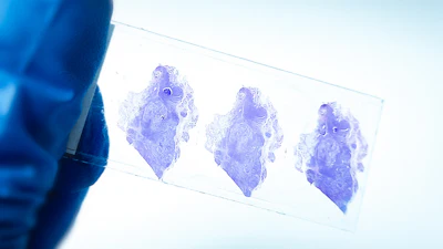 Three purple-stained histological tissue samples on a microscope slide held against light background
