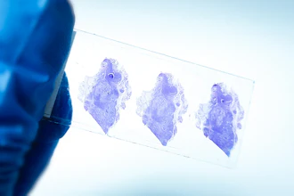 Three purple-stained histological tissue samples on a microscope slide held against light background