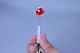 Hand holding a medical diagnostic test device with red collection sphere against blue background