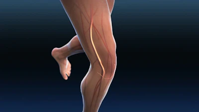 Anatomical illustration of running leg showing muscles and nerve pathways highlighted in red and gold against dark background
