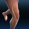Anatomical illustration of running leg showing muscles and nerve pathways highlighted in red and gold against dark background