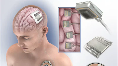 Paradomics brain implant technology illustration showing neural electrode placement, device components, and surgical instruments