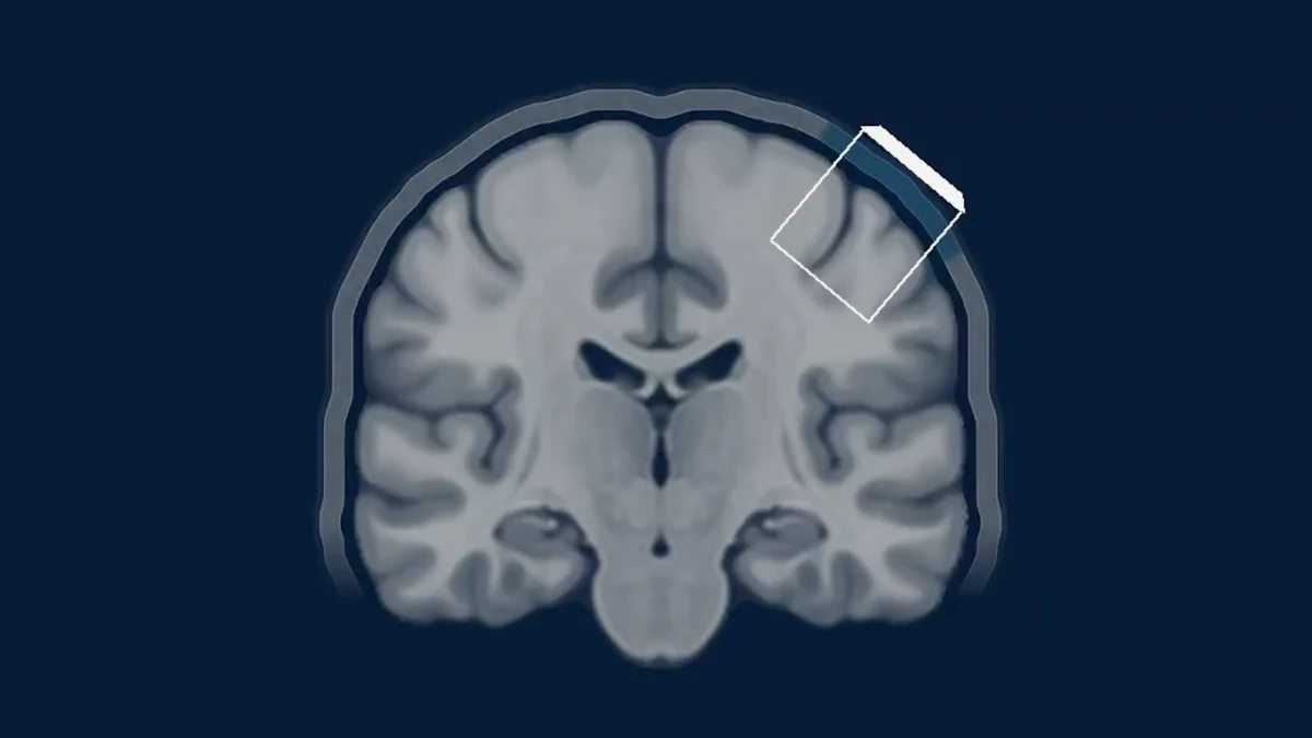Medical Instrument Signage Former Google Health Research Lead Pursues Non-invasive BCI Implant ...